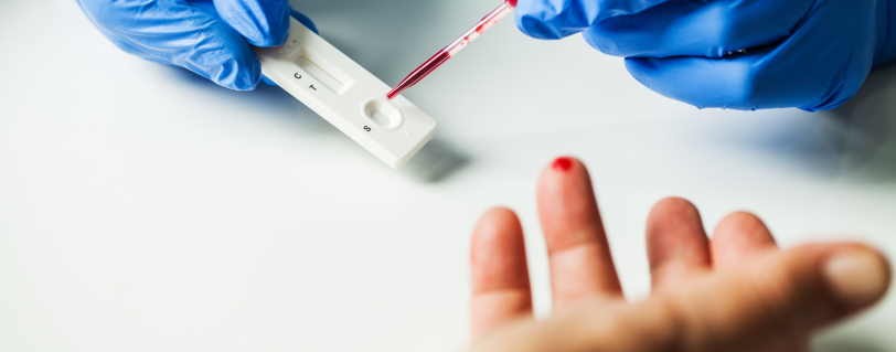 Dispositivi diagnostici in vitro: Commissione Ue propone proroga su entrata in vigore della nuova normativa