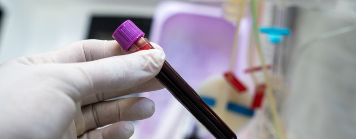 Diagnosi precoce SLA: nuovo marcatore in esame del sangue