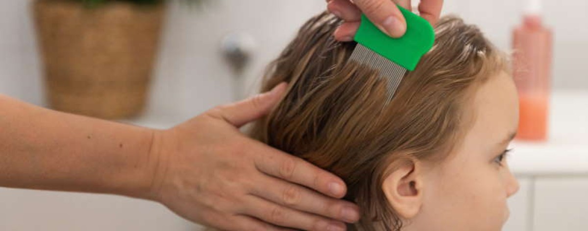 Pidocchi: come riconoscere e trattare la pediculosi in modo efficace. I casi in cui ricorrere al medico
