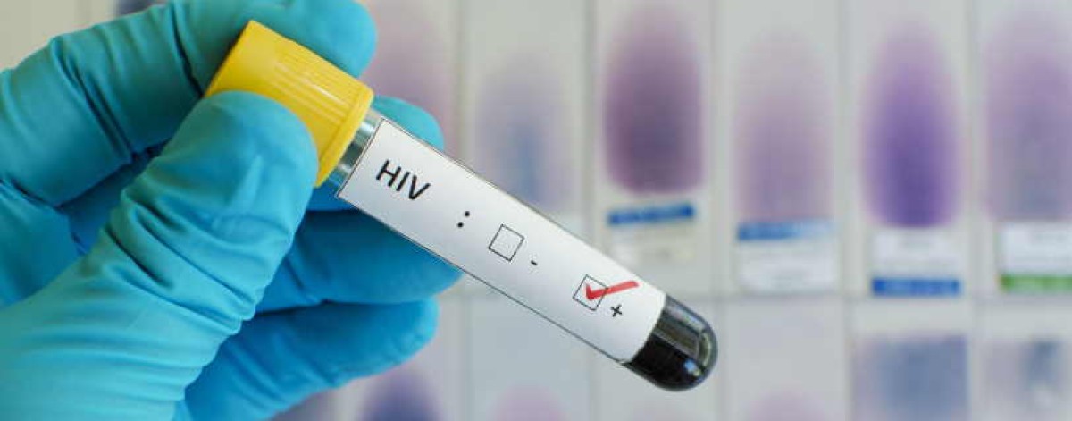 Aids, prevenzione e test: il farmacista in prima linea contro stigma, fake news e diagnosi mancate