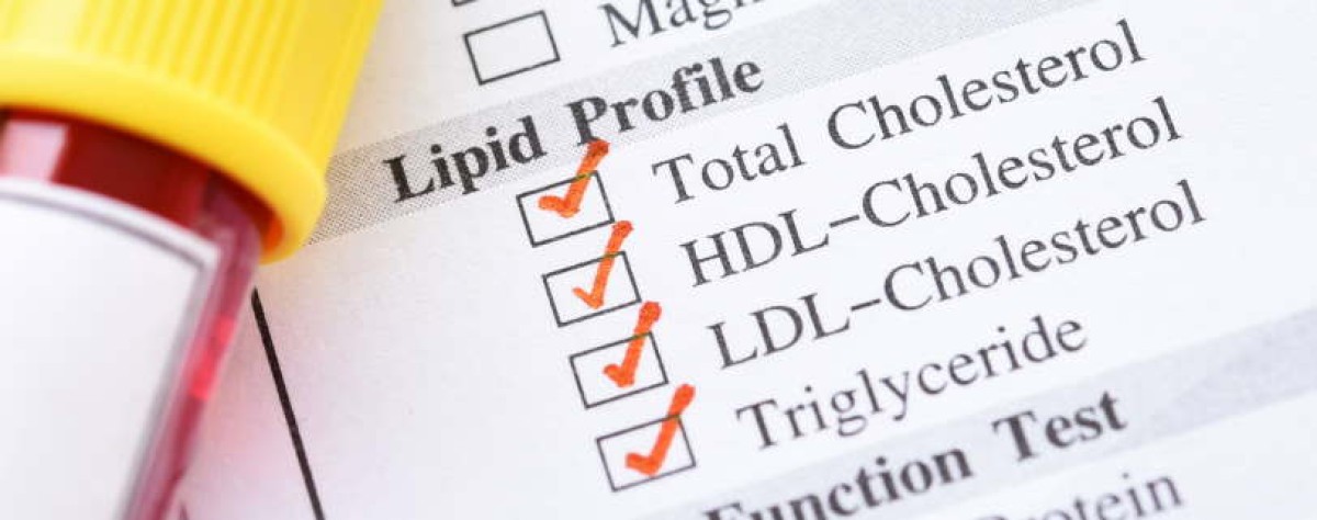 Giovani con colesterolo alto, meno della metà avvia la terapia con statine entro 5 anni