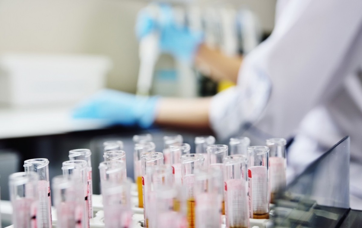 Politerapia può accelerare l’invecchiamento biologico. Nuovo studio di epigenetica