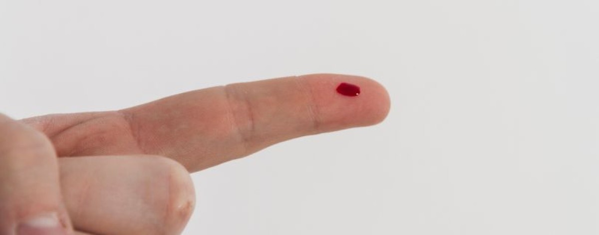 Alzheimer, diagnosi possibile con test su sangue capillare: promette accuratezza elevata