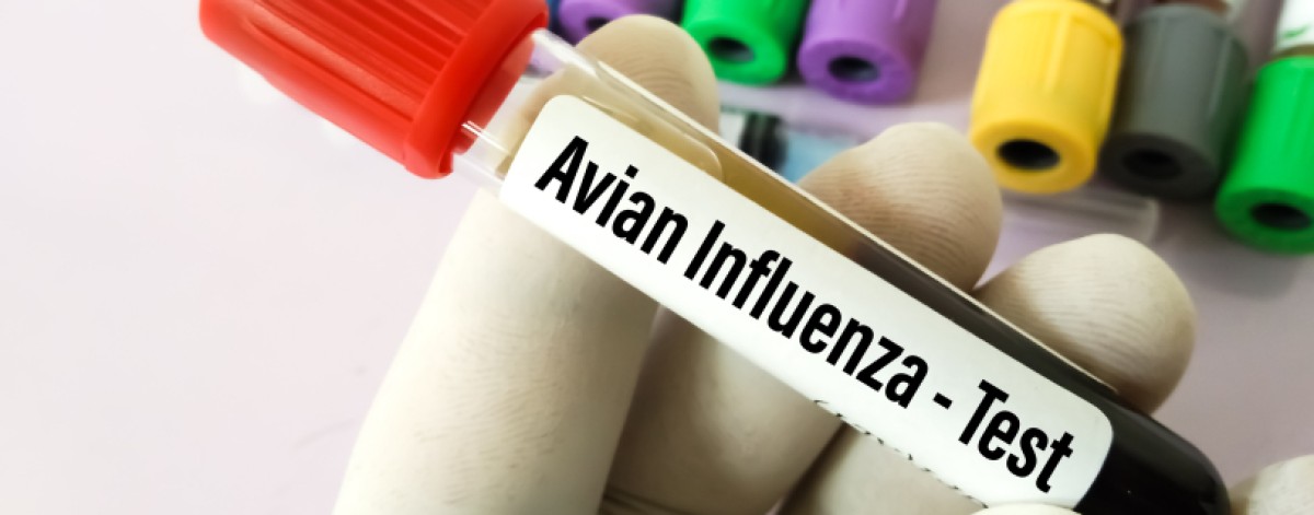 influenza aviaria test