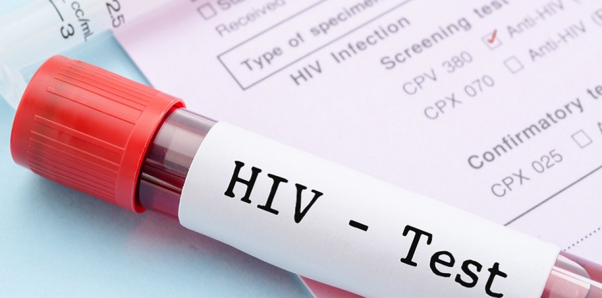 Test salivare rapido Hiv gratuito in 40 farmacie di Bergamo: come funziona e a chi è rivolto 
