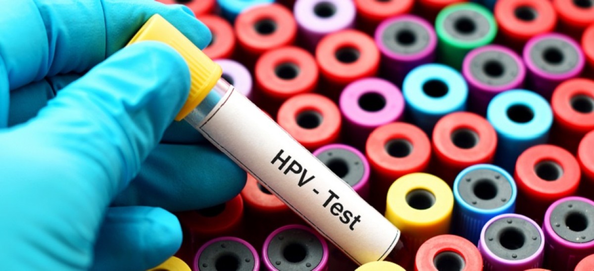 hpv test