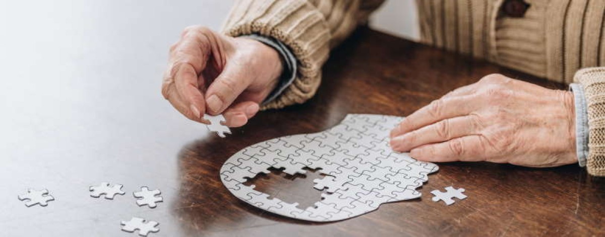 Alzheimer, Aifa conferma no a rimborsabilità di farmaci anti beta-amiloide: beneficio clinico modesto