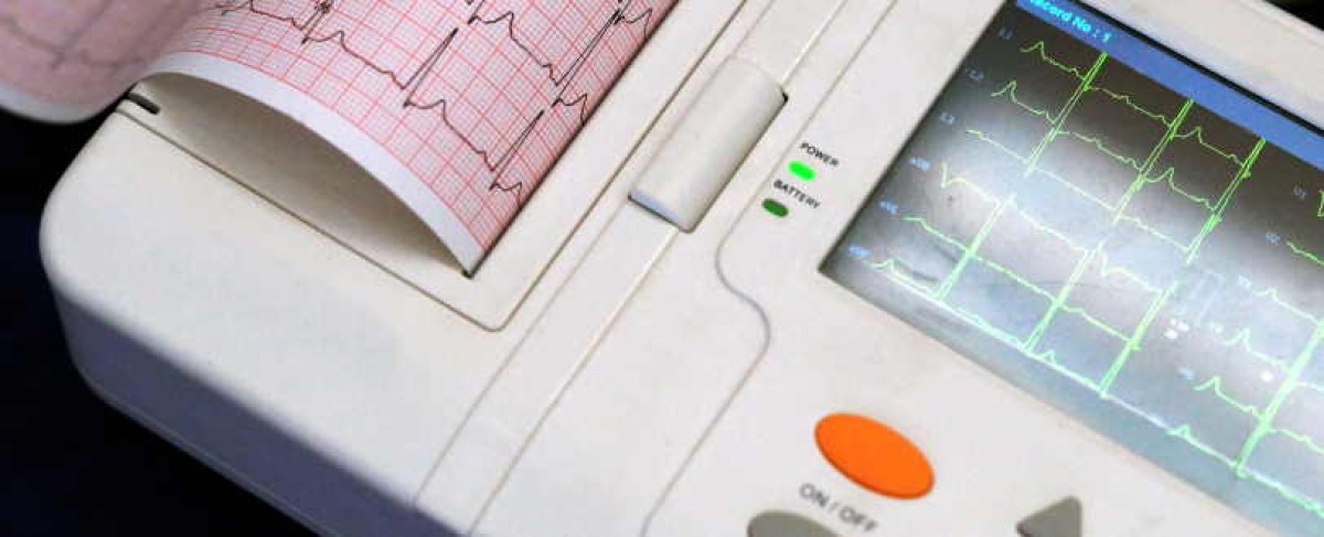 Ecg in farmacia, due anomalie cardiache rilevate: pazienti ricoverati in cardiologia