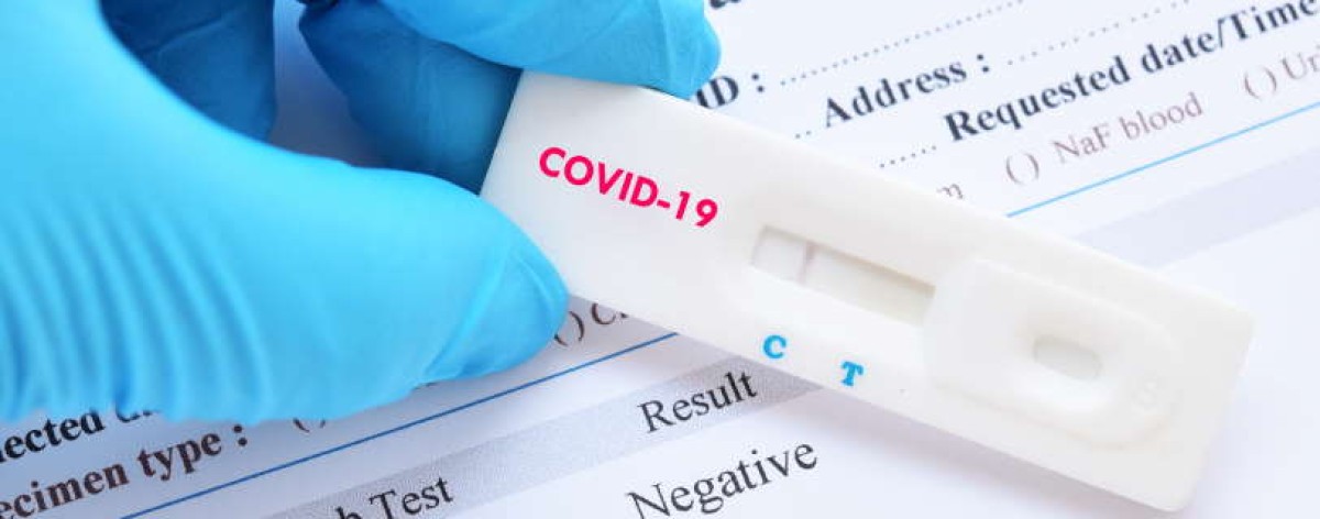 test covid