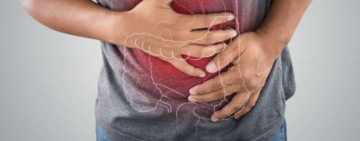 Colite intestino