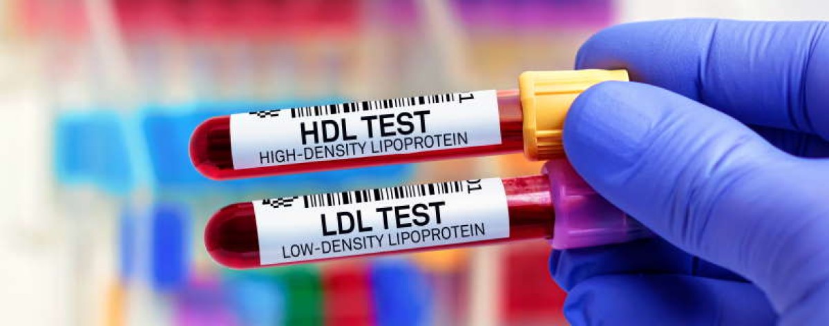 colesterolo test